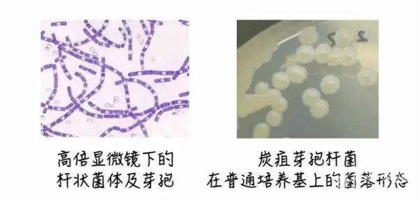 汛期是炭疽高发期 疾控提醒：主要有三种感染途径