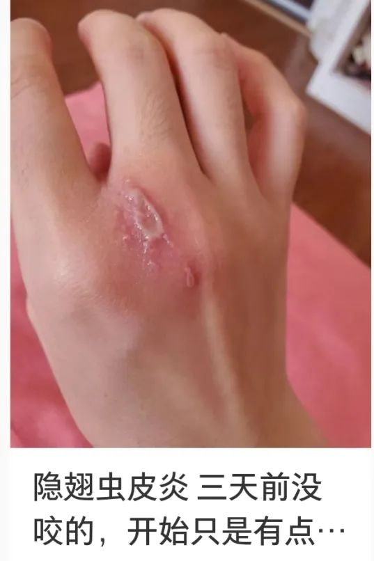 它又来了?男子莫名中招!受害者一堆,很多没见到“元凶” 它又来了?男子莫名中招!受害者一堆,很多没见到“元凶”