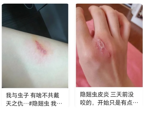 男子突然中招，很多人吃尽苦头！赶紧收手，碰不得...