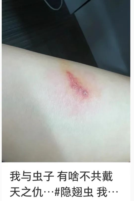 它又来了?男子莫名中招!受害者一堆,很多没见到“元凶” 它又来了?男子莫名中招!受害者一堆,很多没见到“元凶”