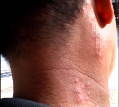 男子突然中招，很多人吃尽苦头！赶紧收手，碰不得...