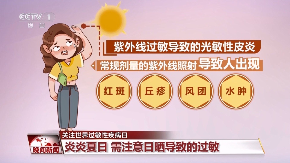 炎炎夏日 遇上这些过敏性疾病该怎么办？