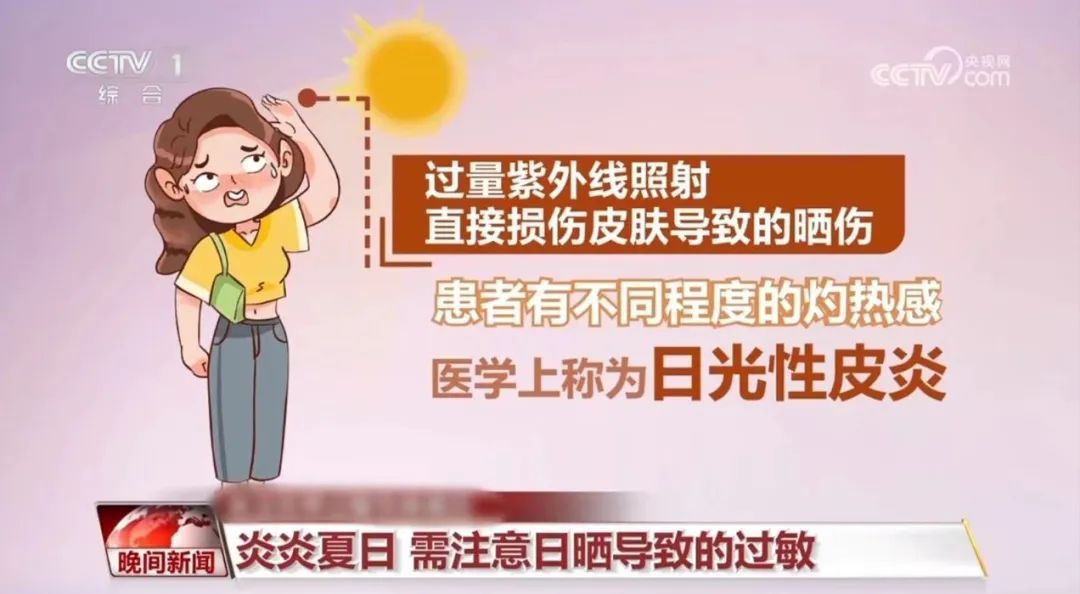 皮肤红肿、瘙痒？你可能“对太阳过敏”！防护指南快查收→