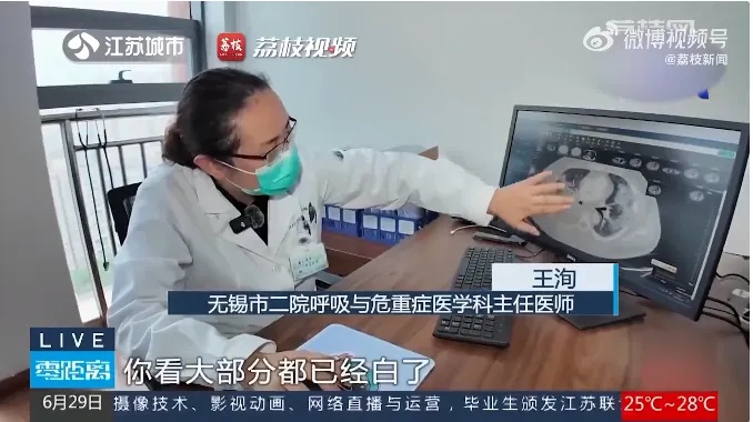 不要淋雨！已经有人"白肺"