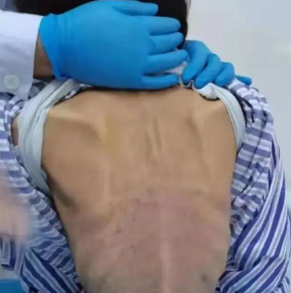 太吓人!女子1米6体重50斤仍在减肥:个人喜欢,不影响生活 太吓人!女子1米6体重50斤仍在减肥:个人喜欢,不影响生活