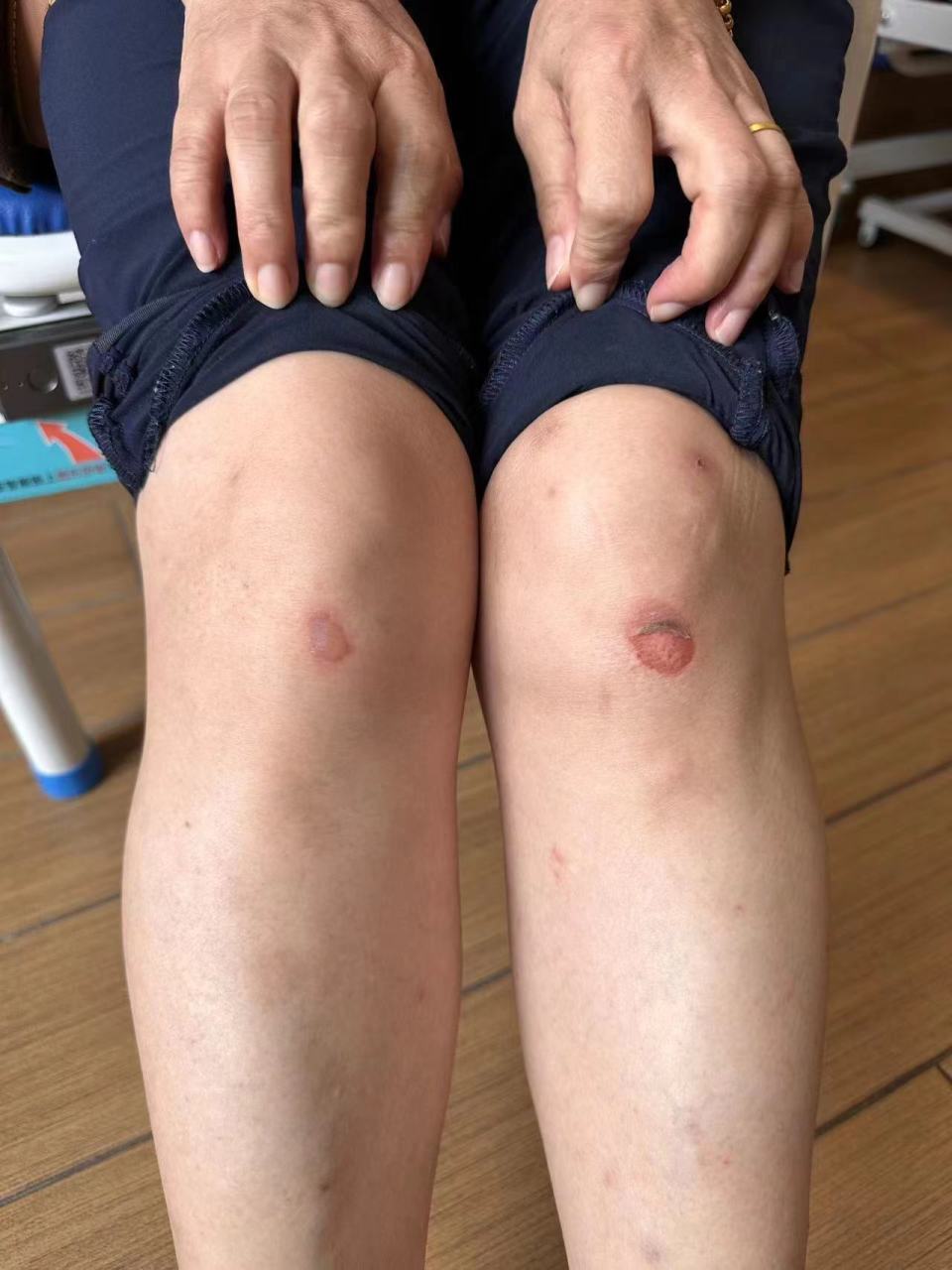 路遇大姐晕倒吐白沫,无锡女护士烈日下跪地救人,救完才发现膝盖破皮 路遇大姐晕倒吐白沫,无锡女护士烈日下跪地救人,救完才发现膝盖破皮