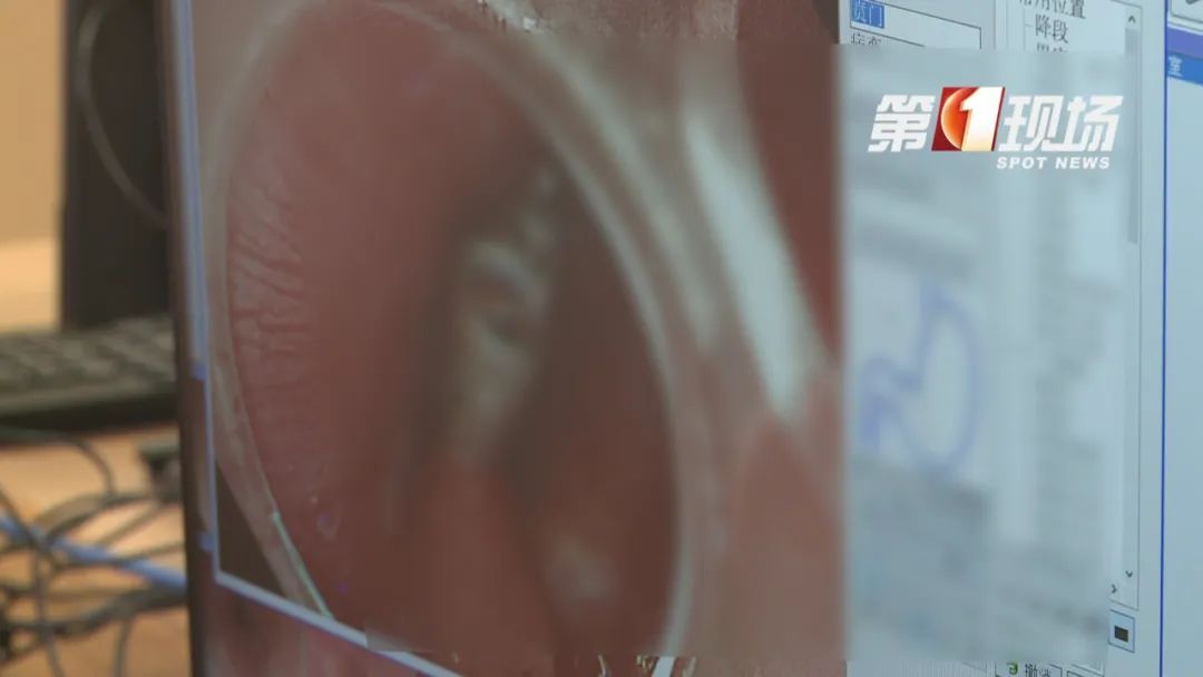 吃泡面竟引发消化道出血!这类人群高发,尤其夏天 吃泡面竟引发消化道出血!这类人群高发,尤其夏天