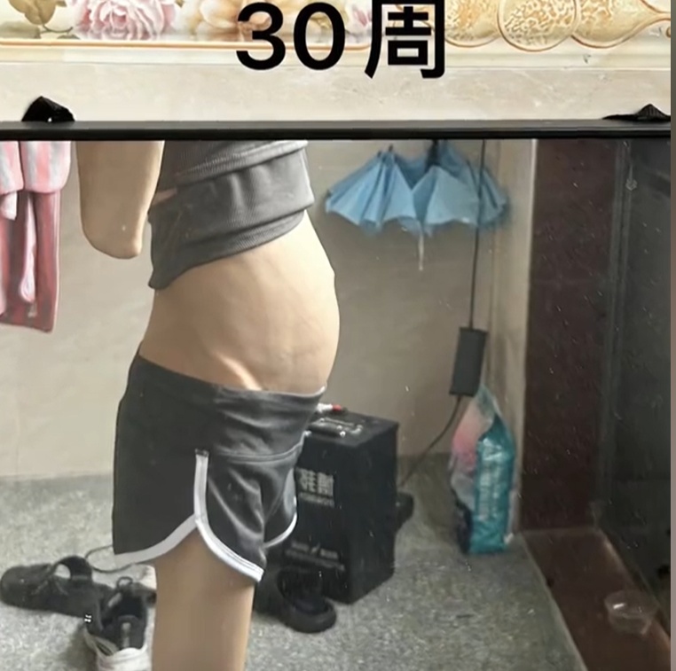 太吓人！女子1米6的身高才50斤？怀孕也一斤没涨？网友惊了……