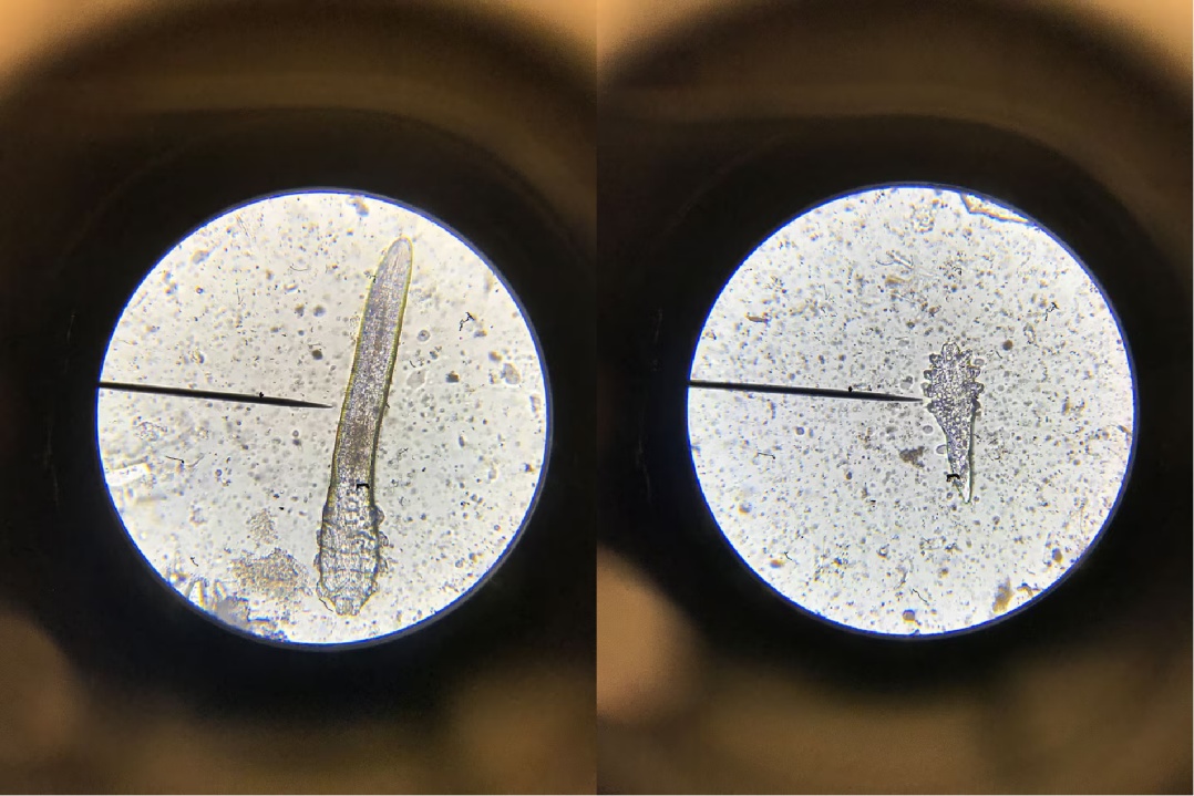 它们趁你睡觉爬上你的脸，还在你脸上交配，对你的依赖让它们走上绝路