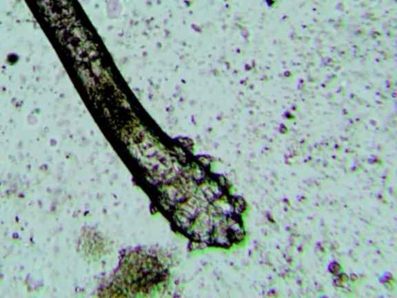 它们趁你睡觉爬上你的脸，还在你脸上交配，对你的依赖让它们走上绝路