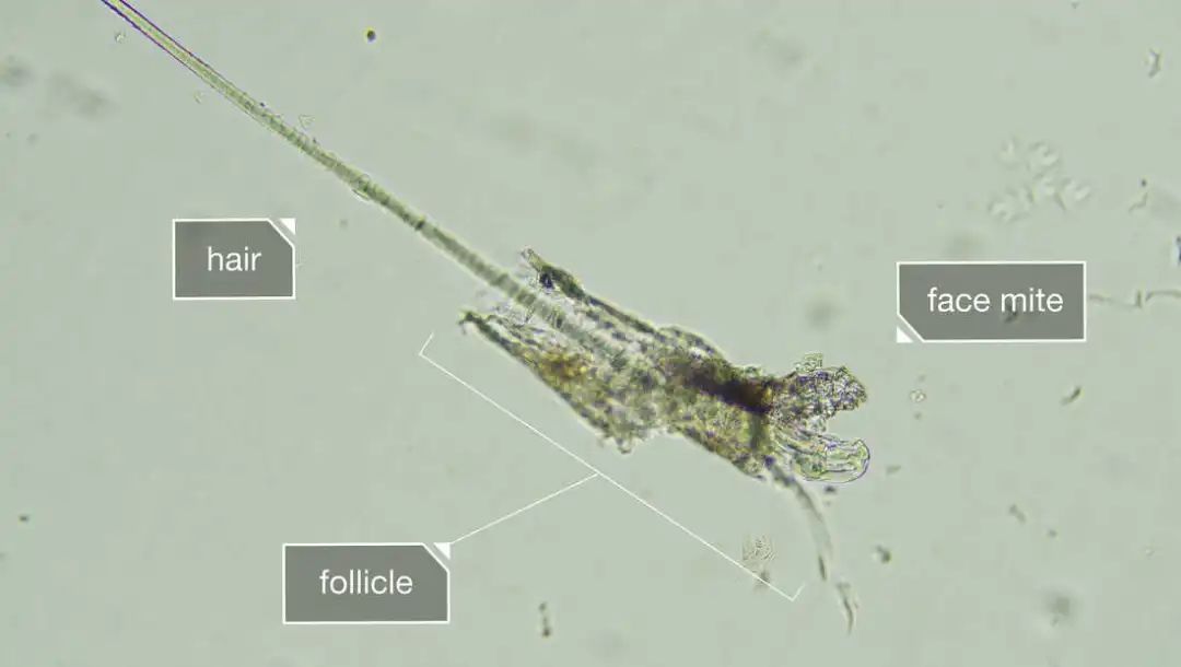 它们趁你睡觉爬上你的脸，还在你脸上交配，对你的依赖让它们走上绝路