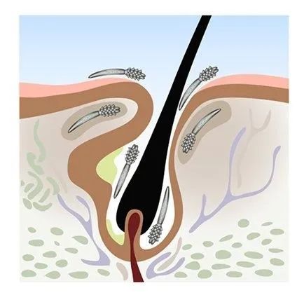 它们趁你睡觉爬上你的脸，还在你脸上交配，对你的依赖让它们走上绝路