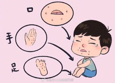 打了手足口疫苗，就一定不得手足口病吗？