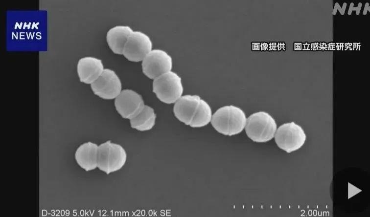致死率30%！日本已有1144例食人菌感染病例，这两类人群注意→