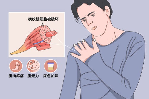 事关长沙人最爱吃的小龙虾，湖南疾控最新提醒