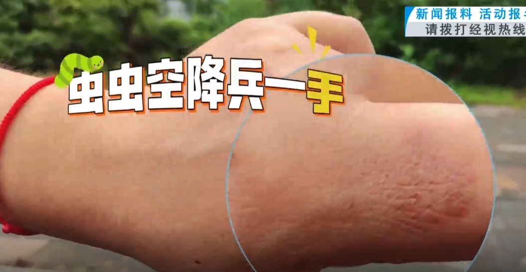 武汉这条路出现大量吊丝的虫!原来是它在作怪……专家提醒 武汉这条路出现大量吊丝的虫!原来是它在作怪……专家提醒