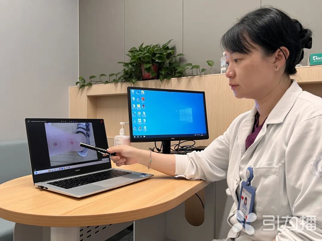 不是蚊子包！近期这类患者增多，医生提醒