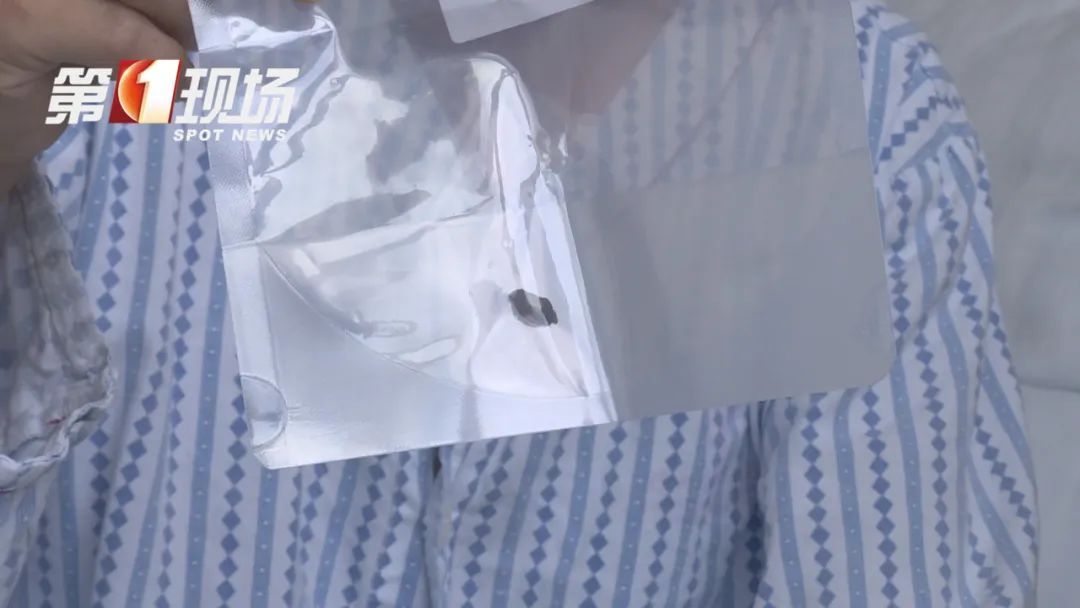 飞来横祸！男子胸口被小碎石“击穿”，离心脏仅1厘米…