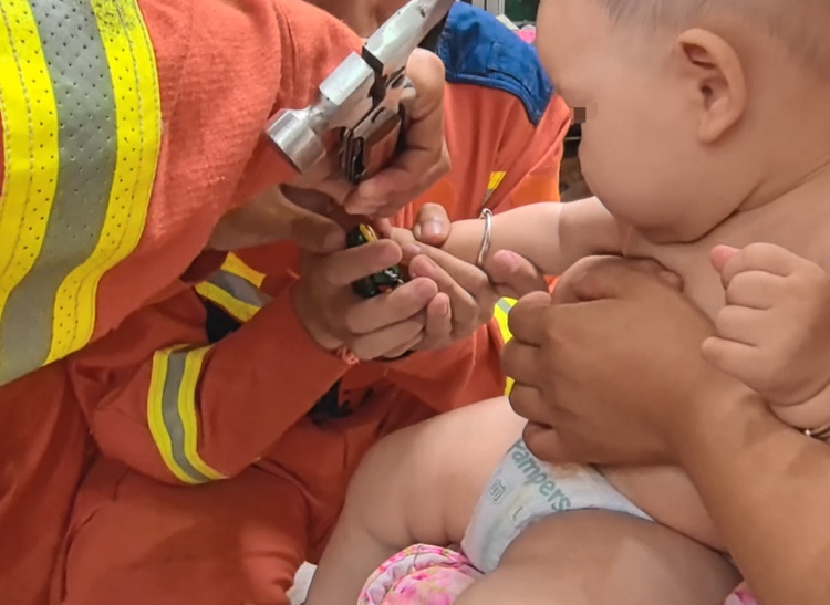 童年“伙伴”变“噩梦”,这只“青蛙”“咬”住6个月宝宝…… 童年“伙伴”变“噩梦”,这只“青蛙”“咬”住6个月宝宝……