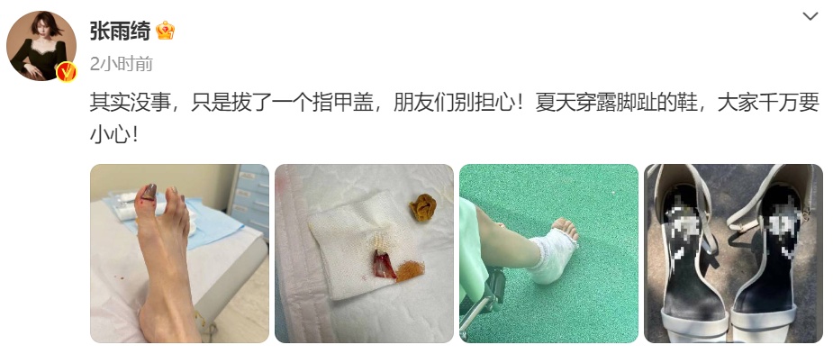 知名女演员突发意外！网友：看着都疼！又是它惹的祸……