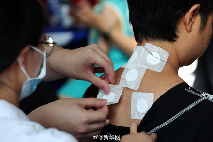 “三伏天”,这些疾病适合“冬病夏治” “三伏天”,这些疾病适合“冬病夏治”