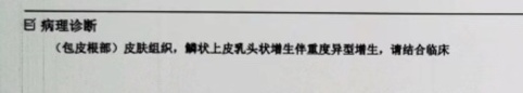 确认癌症复发!女子跌入深渊:明明此前已转阴…元凶竟在丈夫身上! 确认癌症复发!女子跌入深渊:明明此前已转阴…元凶竟在丈夫身上!