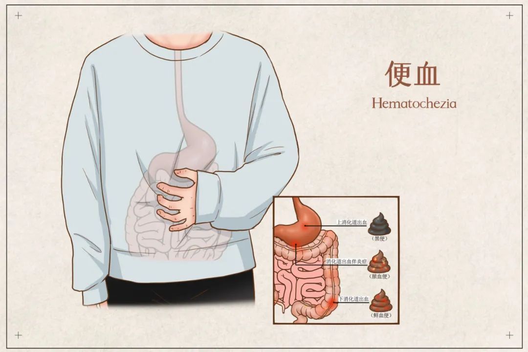 浙江一家8口确诊同种病，一人患癌！医生：遗传性极强，若不干预35岁前很有可能……