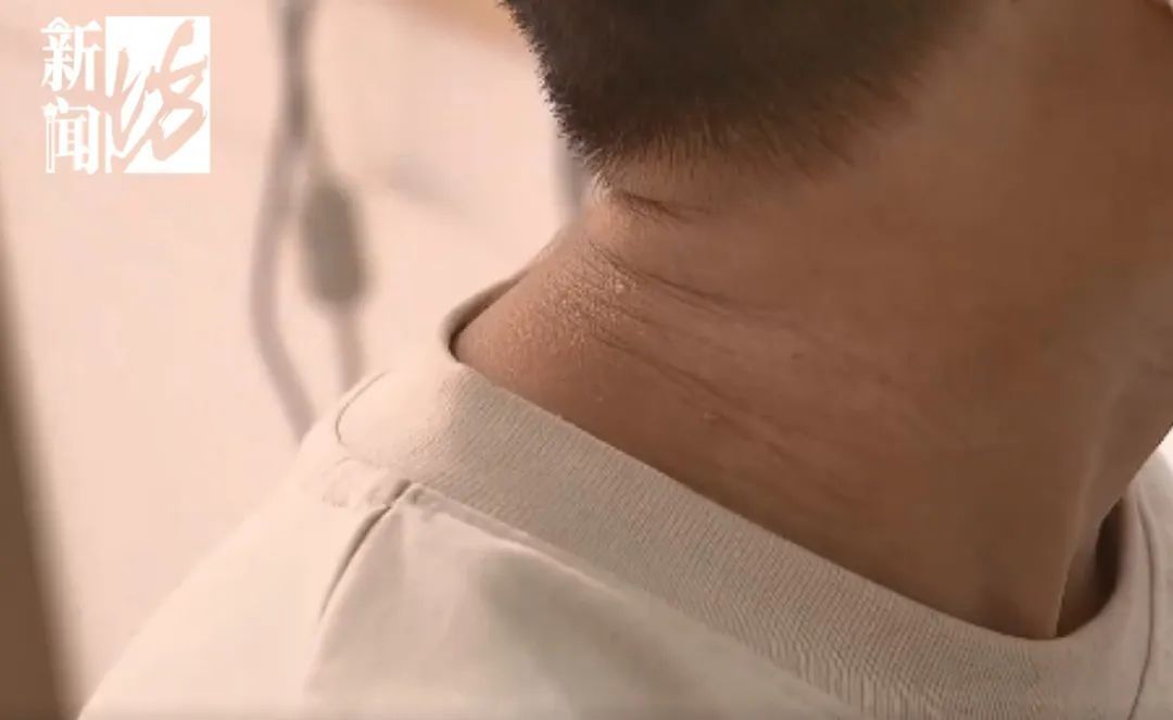 很多上海人有这种难言之隐！最近卷土重来？专家提醒：这种情况别混淆→