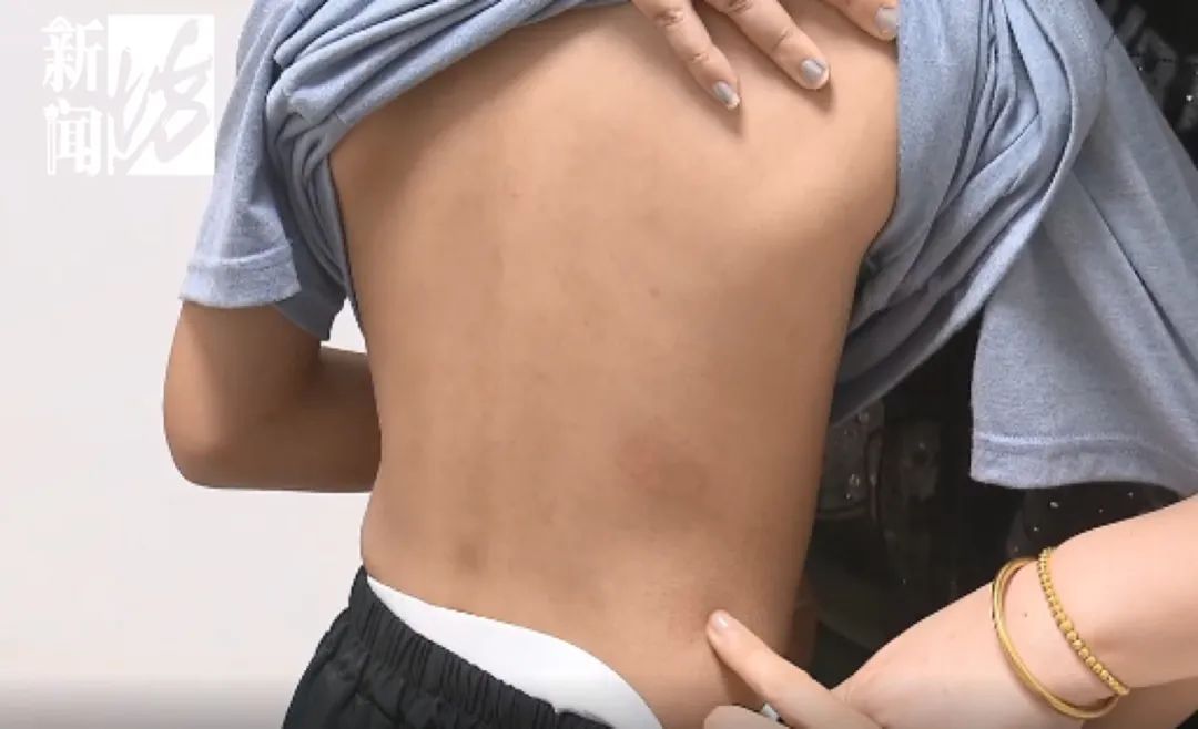 很多上海人有这种难言之隐！最近卷土重来？专家提醒：这种情况别混淆→