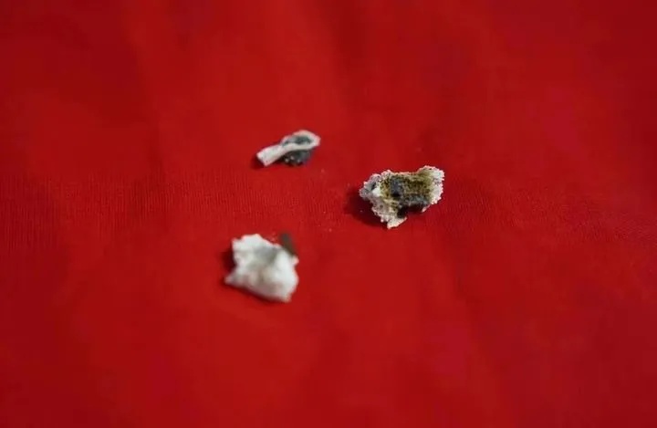 他去世了,骨灰中发现3枚弹片…… 他去世了,骨灰中发现3枚弹片……