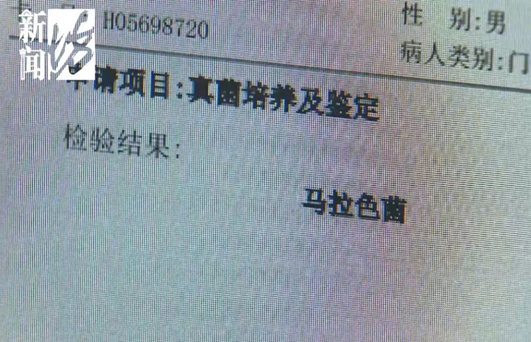 很多上海人有这种难言之隐！最近卷土重来？专家提醒：这种情况别混淆→