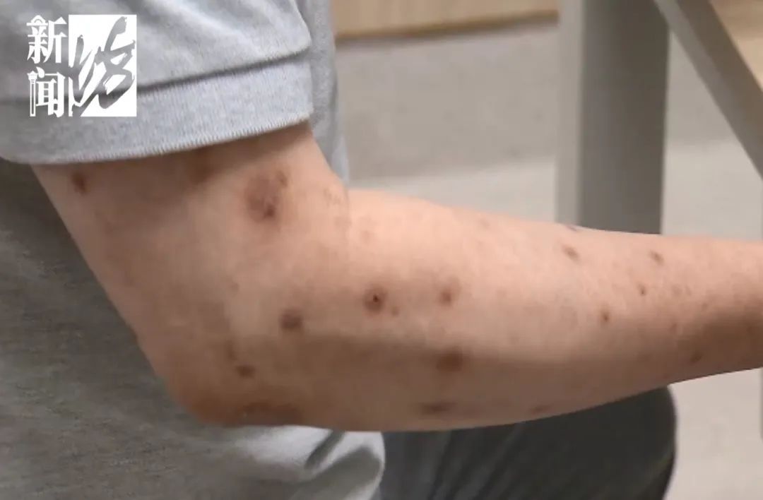 很多上海人有这种难言之隐！最近卷土重来？专家提醒：这种情况别混淆→