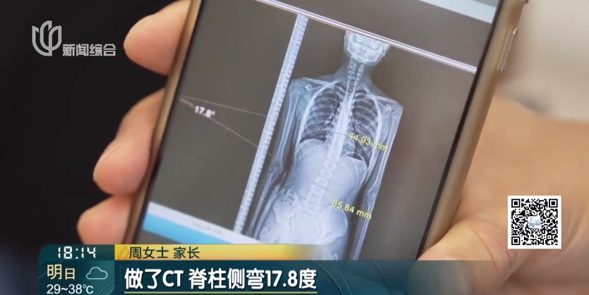 上海女演员被嘲"残疾"?这病千万别忽视,近期沪上门诊量迎高峰 上海女演员被嘲"残疾"?这病千万别忽视,近期沪上门诊量迎高峰