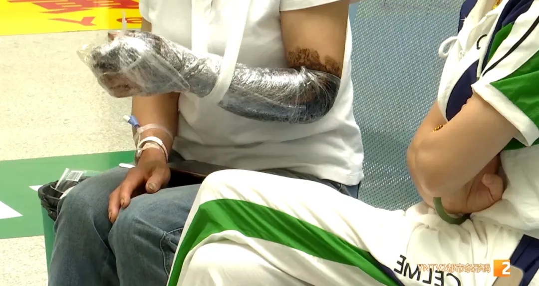 近期患者数量攀升，云南已有近200例！医生紧急提醒……