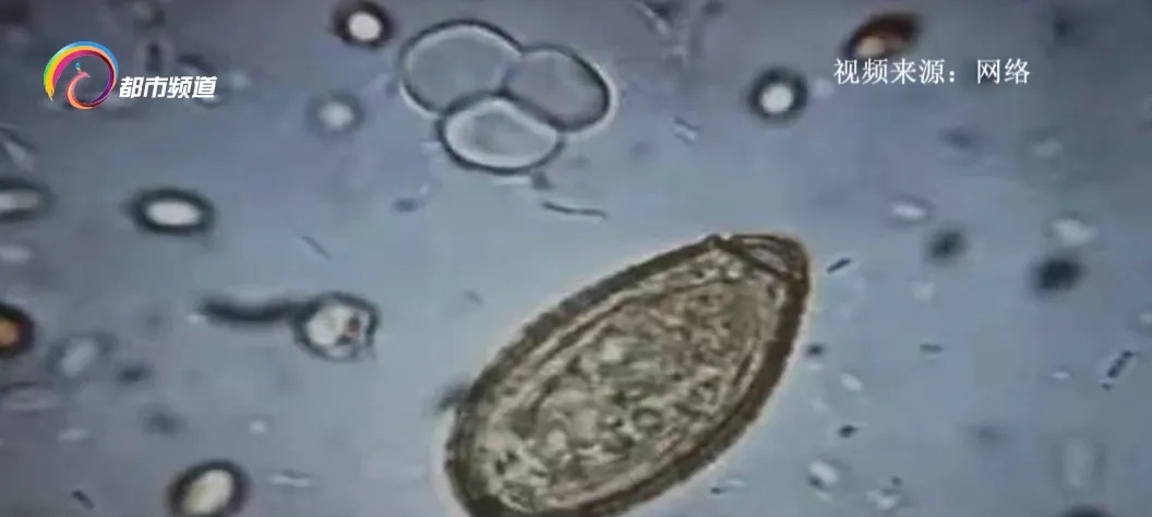 男子头痛,检查发现脑里有一圈一圈的东西!真相细思极恐,很多人爱吃…… 男子头痛,检查发现脑里有一圈一圈的东西!真相细思极恐,很多人爱吃……