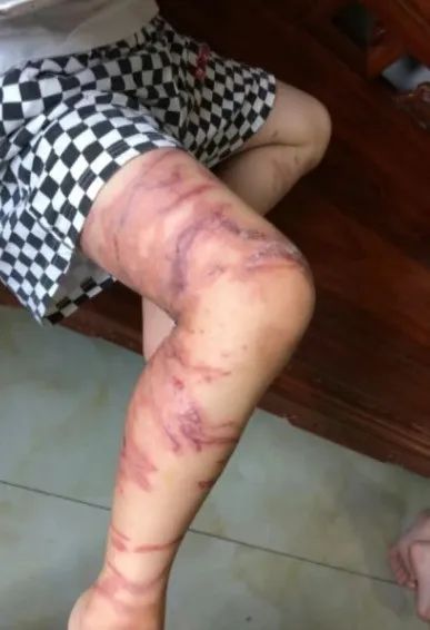 可致心脏骤停!这种“塑料袋”千万别碰→ 可致心脏骤停!这种“塑料袋”千万别碰→