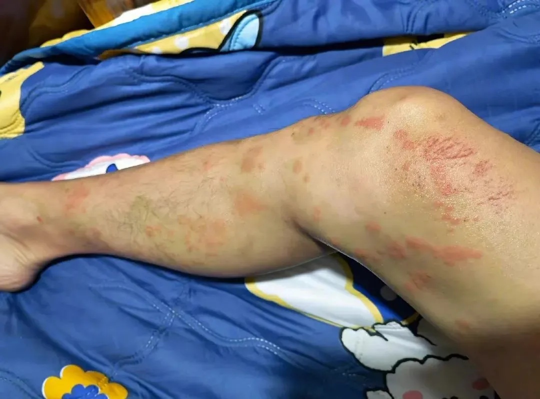 可致心脏骤停!这种“塑料袋”千万别碰→ 可致心脏骤停!这种“塑料袋”千万别碰→