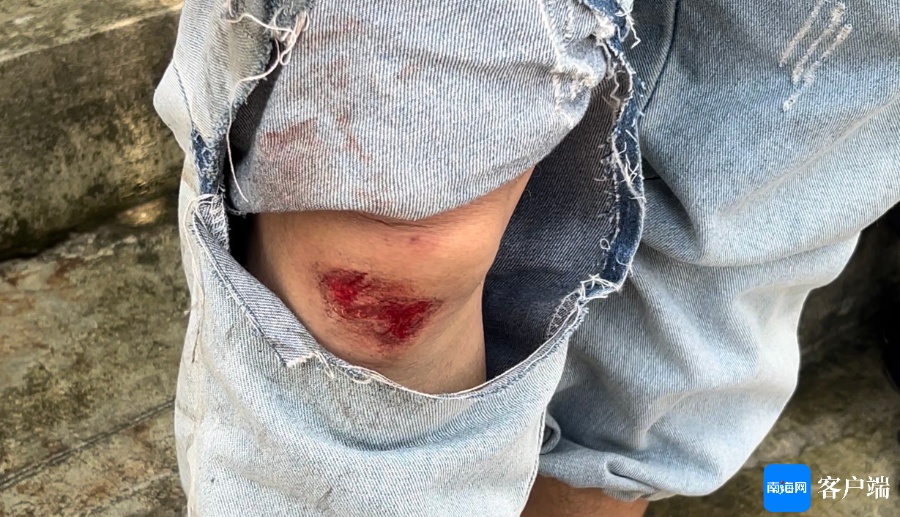 海口一骑行道地沟油溢出，致多人摔伤