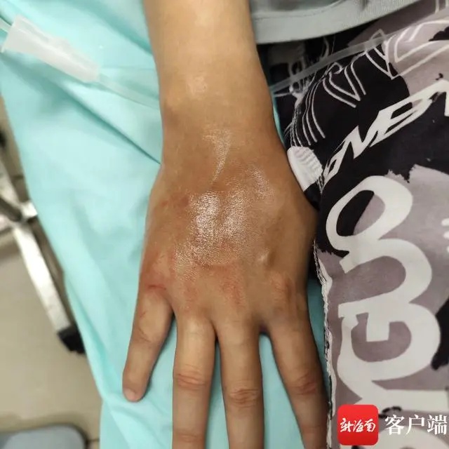 可致心脏骤停!这种“塑料袋”千万别碰→ 可致心脏骤停!这种“塑料袋”千万别碰→