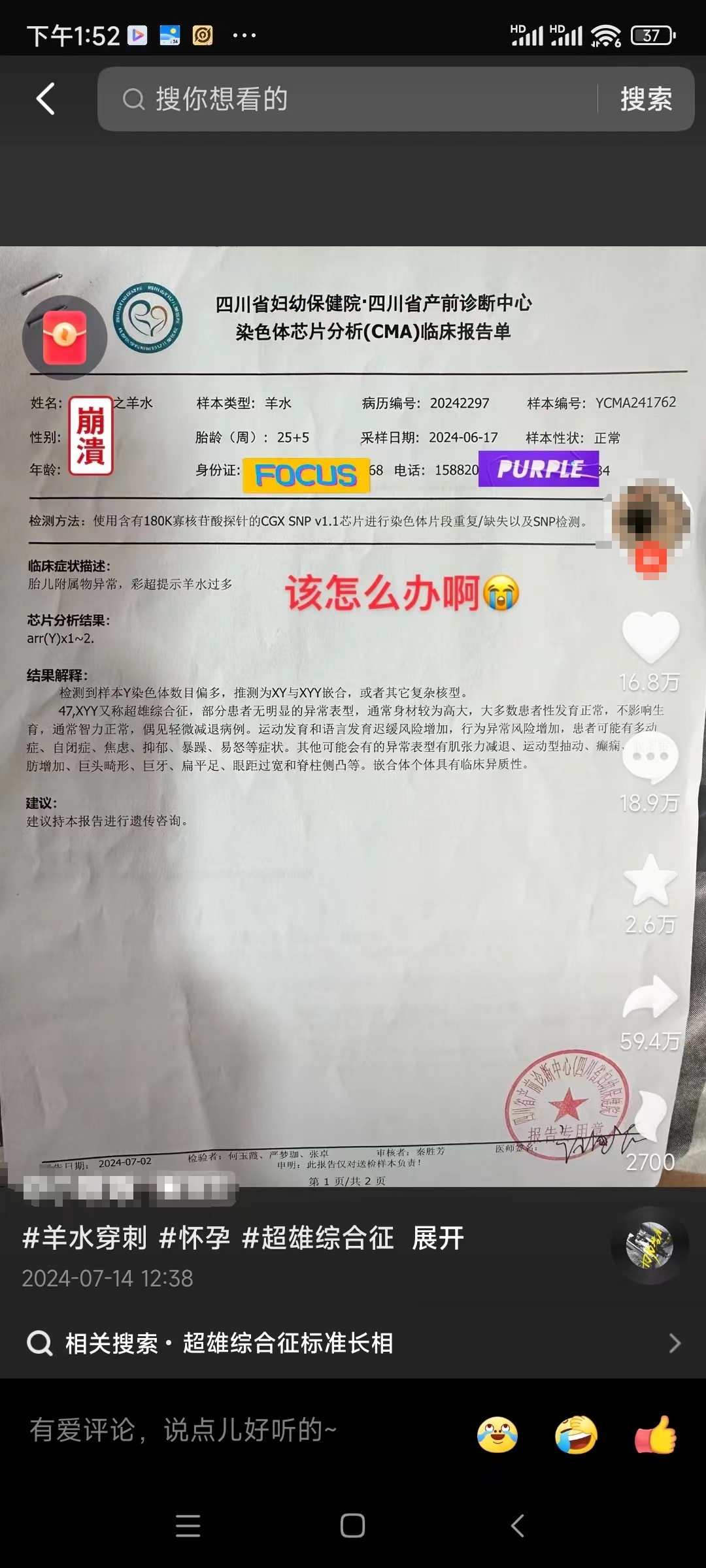 四川“超雄综合征”胎儿母亲决定终止妊娠，专家：“吃掉兄弟”“犯罪基因”都是误解