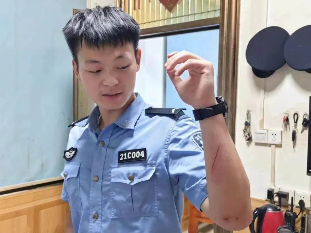 心疼!他伤了好长一道口子 但却很开心 心疼!他伤了好长一道口子 但却很开心