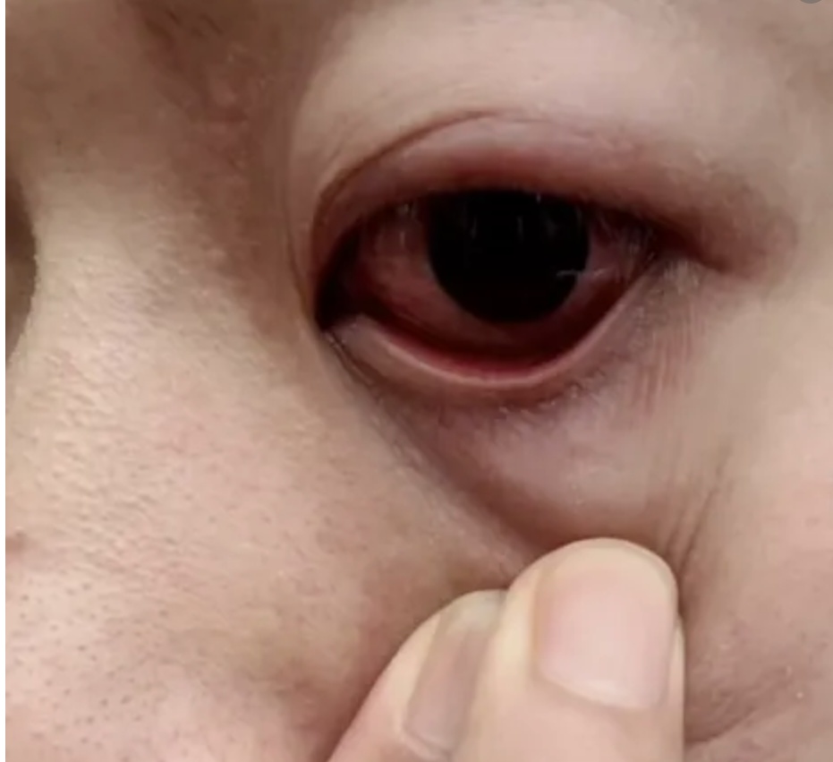 有人在健身房用哑铃做足底按摩？网友：我说手怎么总脱皮...