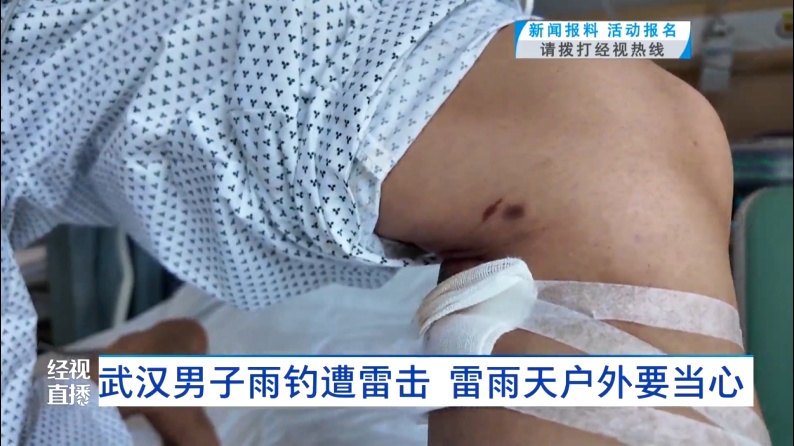 武汉男子雨天一个动作引来闪电……医生：已救治多例！