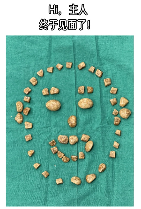 触目惊心!32岁小伙剧烈腹痛,膀胱竟掏出3斤结石,49块“鹅卵石”大…… 触目惊心!32岁小伙剧烈腹痛,膀胱竟掏出3斤结石,49块“鹅卵石”大……