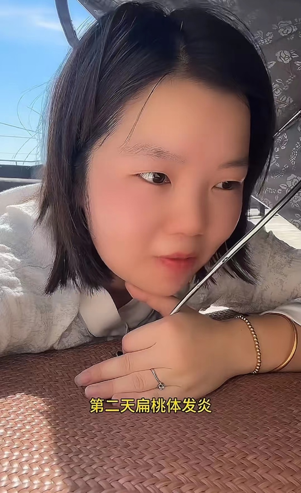 “晒背”10天瘦4斤？女子晒完扁桃体发炎！专家：这些问题要注意