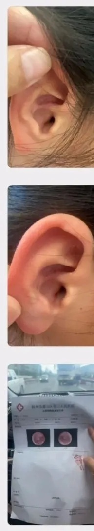 出血昏迷,7岁女孩急入ICU!有儿童甚至死亡,警惕! 出血昏迷,7岁女孩急入ICU!有儿童甚至死亡,警惕!