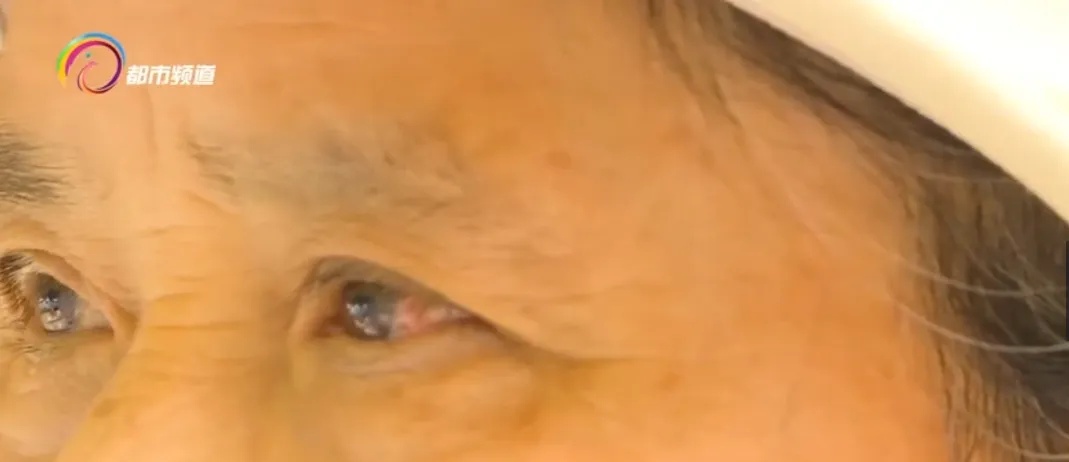 飞来横祸！阿姨眼睛受伤缝4针，是这个玩具导致