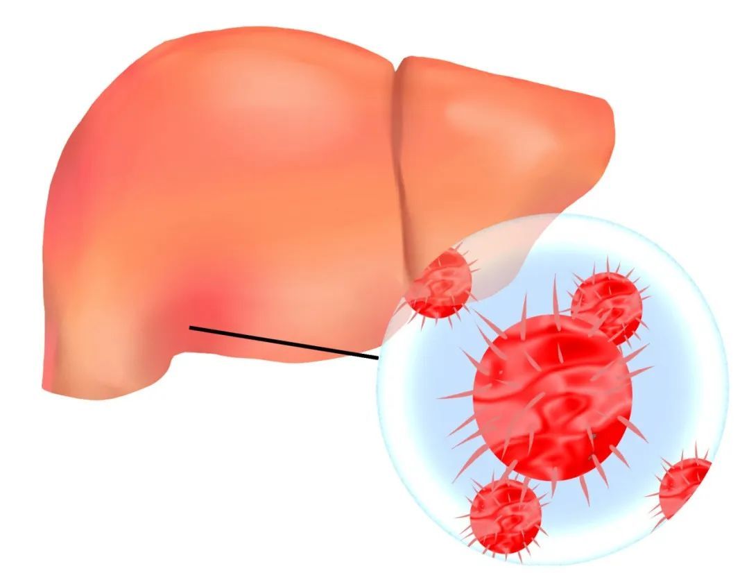 【世界肝炎日】你知道吗？肝功能正常≠没有肝炎！