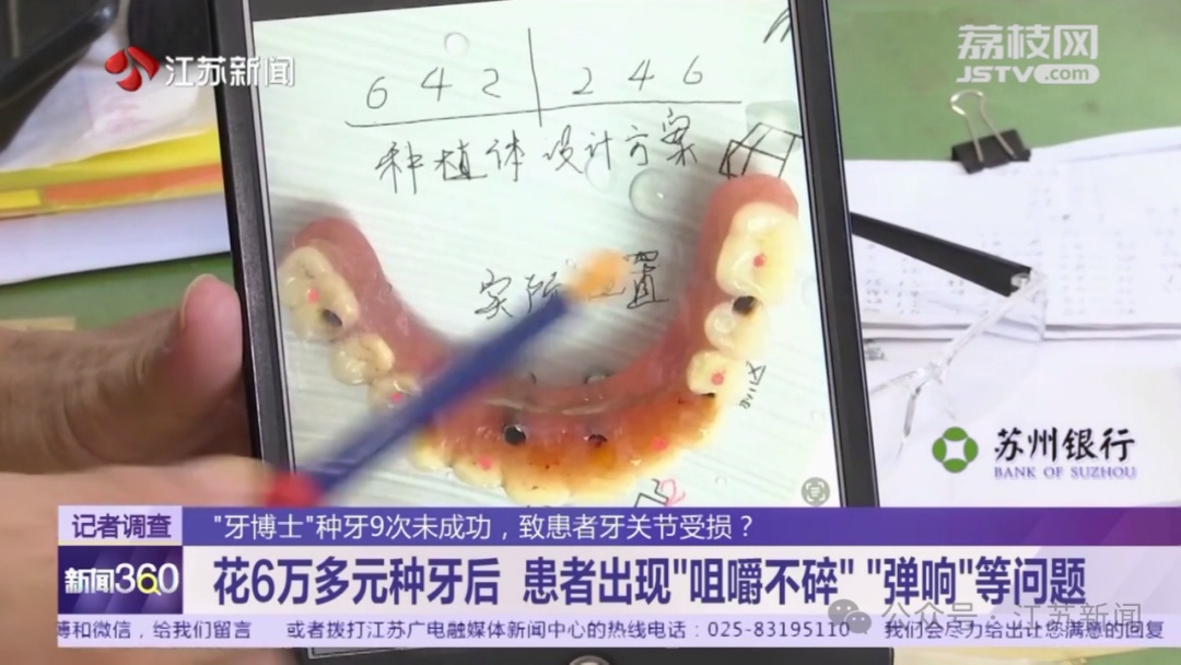 七旬老伯为种牙拔了10颗好牙!没想到花了6万多后竟然...... 七旬老伯为种牙拔了10颗好牙!没想到花了6万多后竟然......