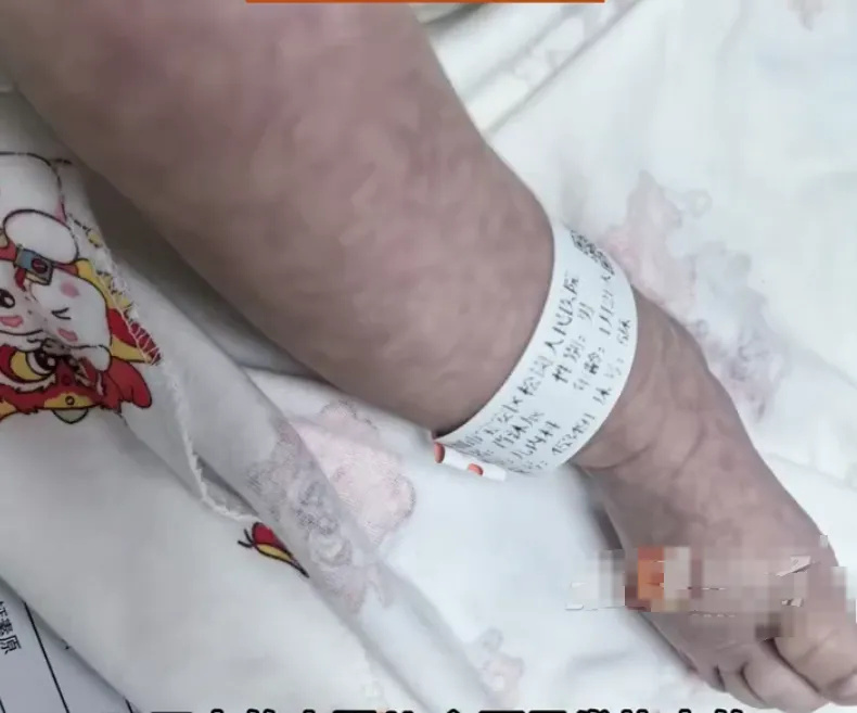 2个月婴儿身体布满“花纹”,发烧后,爸爸这个操作太害人! 2个月婴儿身体布满“花纹”,发烧后,爸爸这个操作太害人!